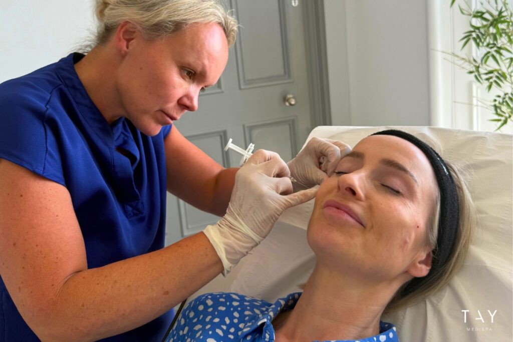 Dermal Fillers in Perth, Tay Medispa